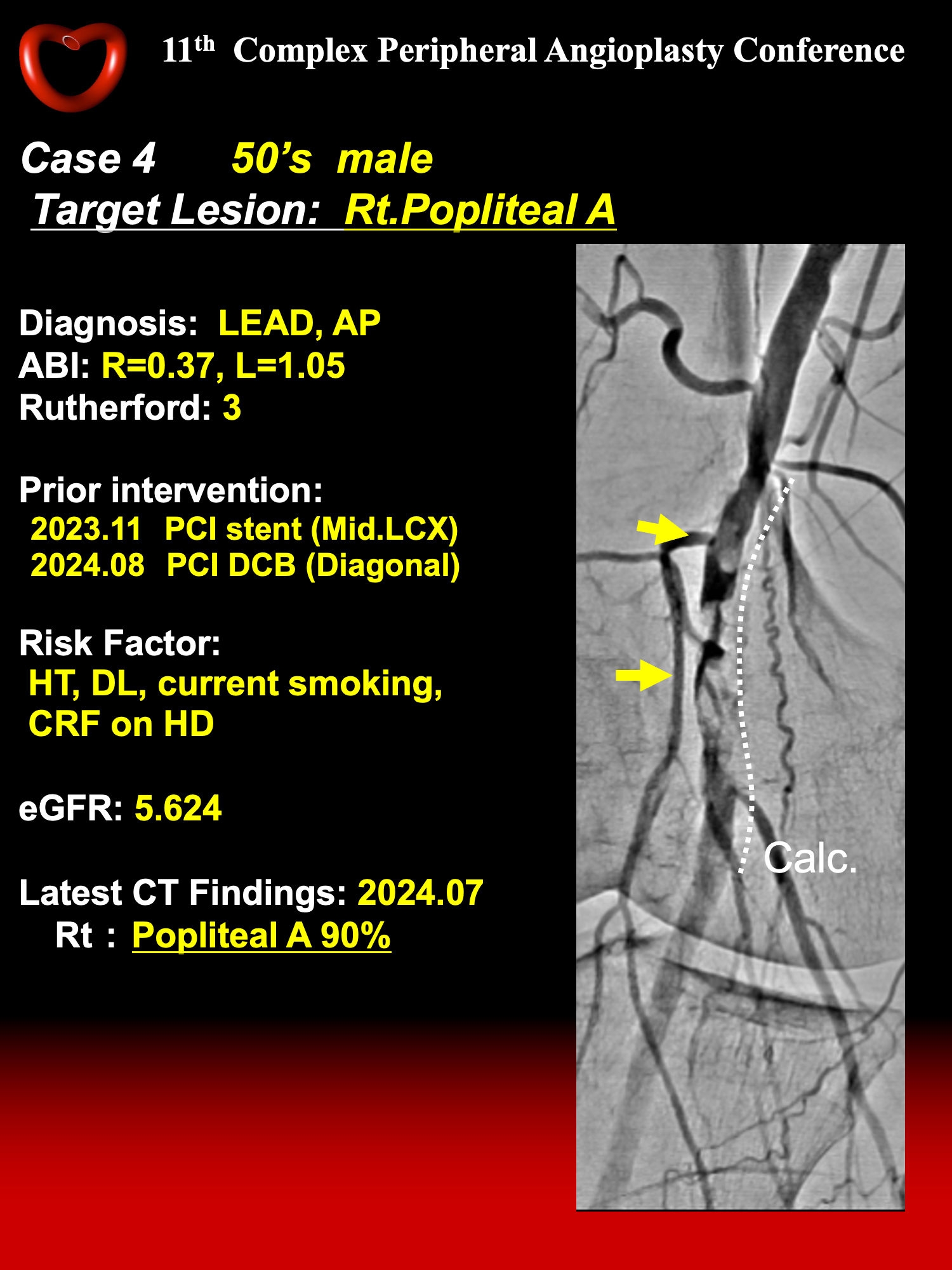 case4